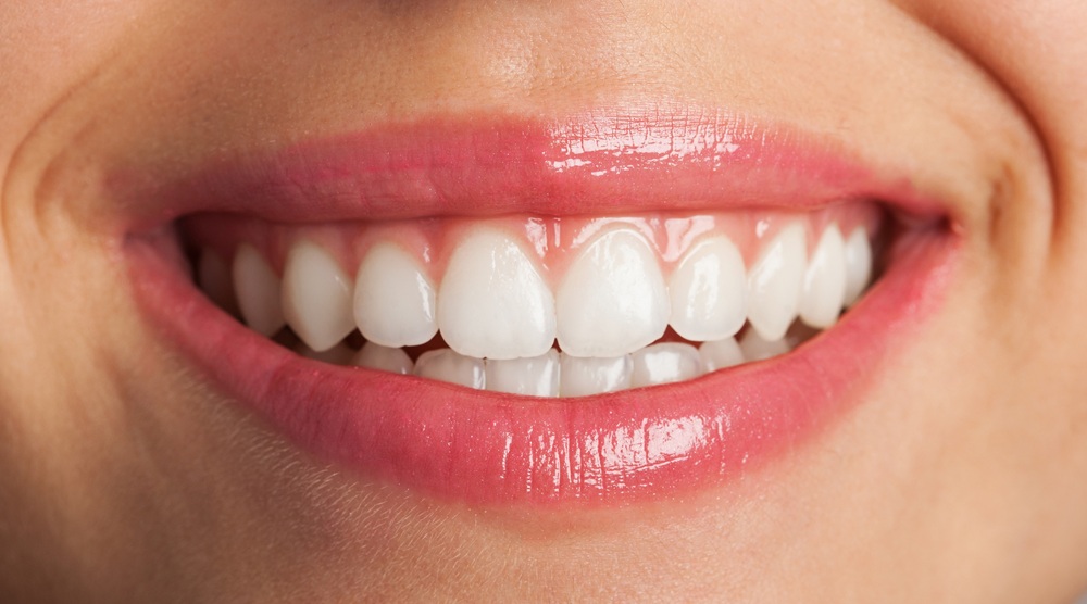 take care of teeth during festival season